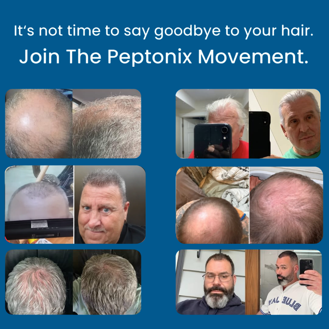 Micro-Infusion Peptide Regrowth System Offer