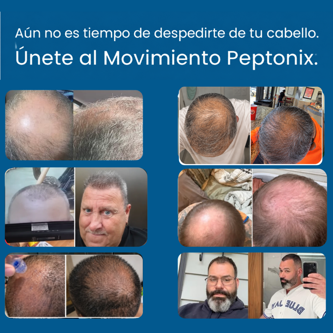 Microinfusión de péptidos para el crecimiento del cabello oferta